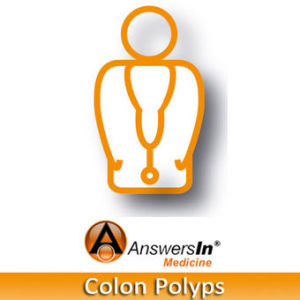 Colon polyps 01 - Polyp biology
